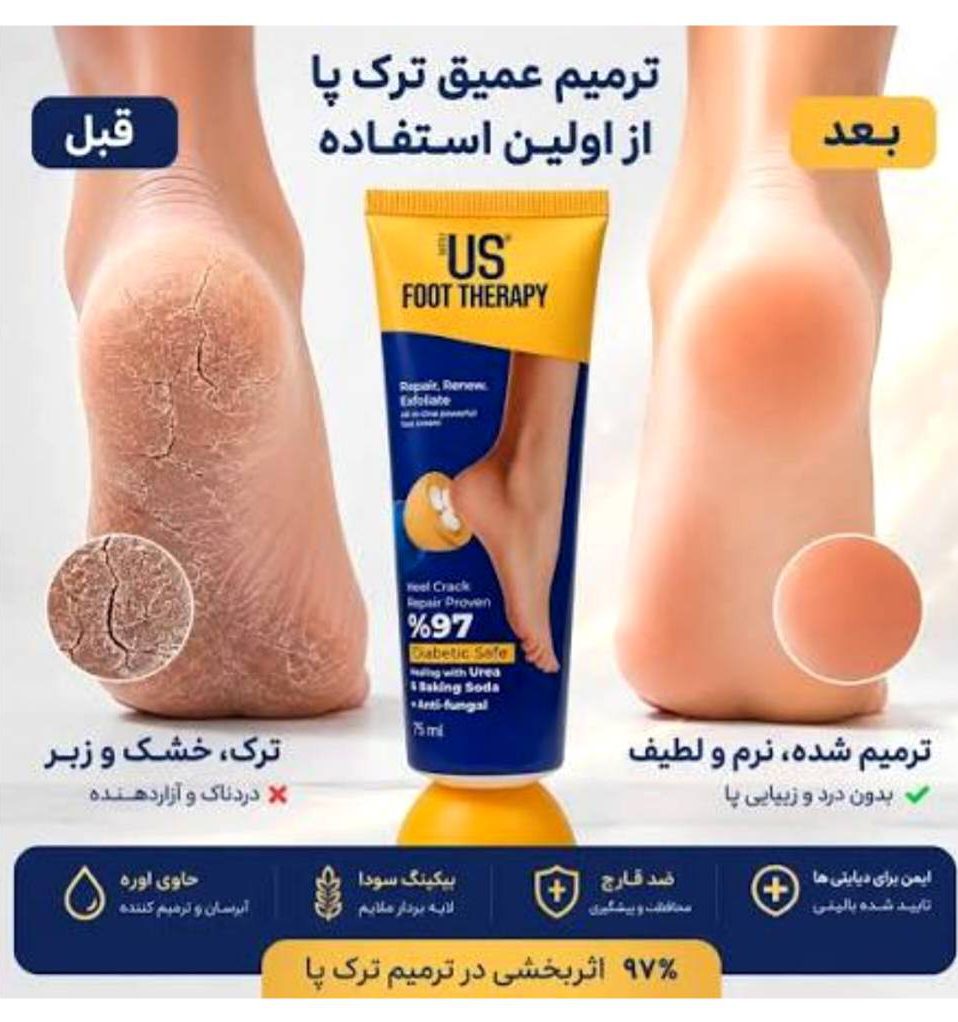 قیمت و خرید کرم مرطوب کننده و ترمیم کننده ترک پا آس همراه ماساژور 75 میلی لیتر